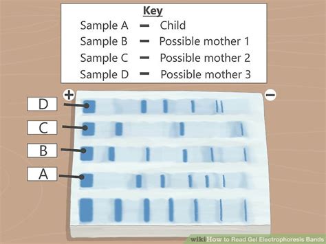 How to Read Gel Electrophoresis Bands: Interpretation Guide .